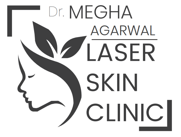 Birthmark Removal Laser Skin Clinic birthmark-removal-laser-skin-clinic